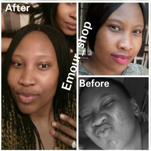 Kojic acid soap with Bearberry & Herbal extracts (140g) - Emour Products