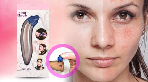 Electric Facial Pore Cleanser Blackhead Remover Vacuum Suction Machine