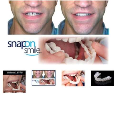 Full Set Teeth Veneers