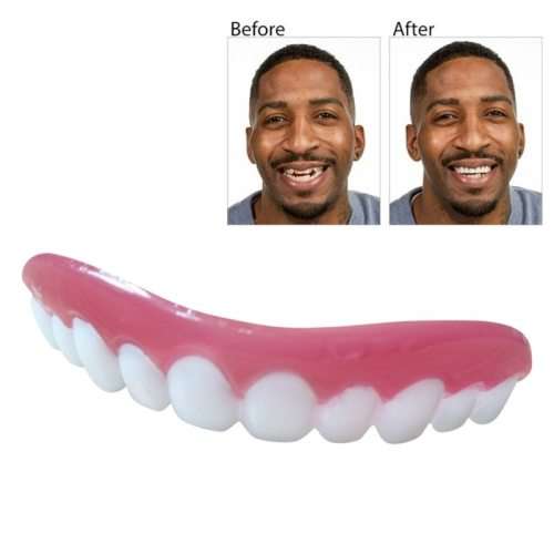 Full Set Teeth Veneers with Case