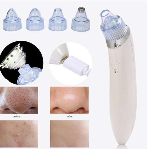 Blackhead Vacuum Acne Cleaner Pore Remover Electric Skin Facial Cleanser Care - White