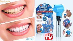 Luma smile teeth whitening polish system kit (KKLE)