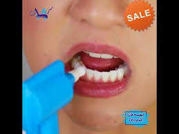 Luma smile teeth whitening polish system kit (KKLE)