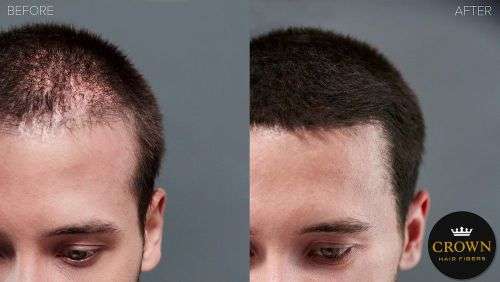 Crown Hair Fibers 25g Conceal Hair Loss - Black