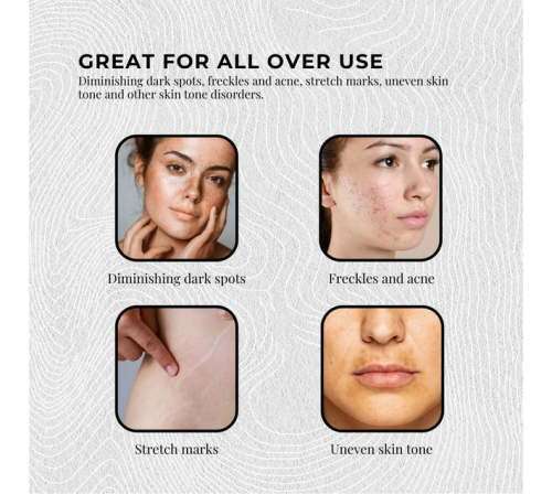 Kojie San Kojic Acid Skin Lightening Soap 135g