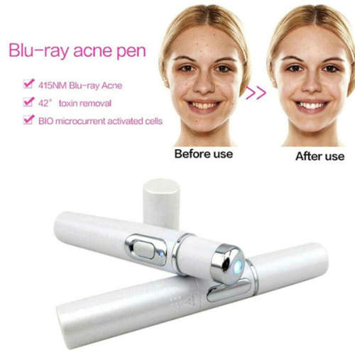 Varicose veins  Pen (Blue Light Therapy) `LOCAL STOCK`