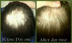 FIRST FOR BOB !!!!!!!!! Peanie Natural Hair Tonic