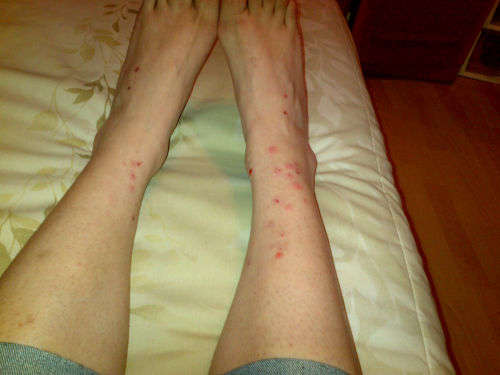 Snail Gel Clay  50ml  by SoOrganic. Wrinkles, Blemishes, pigmentation, acne, eczema, psoriasis etc..