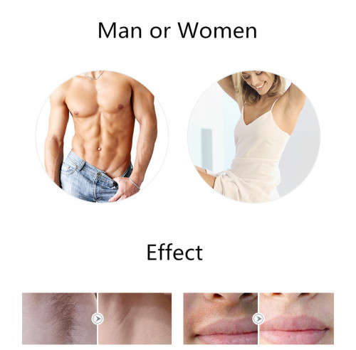 Professional Permanent IPL Laser Light Epilator Hair Removal Unboxed