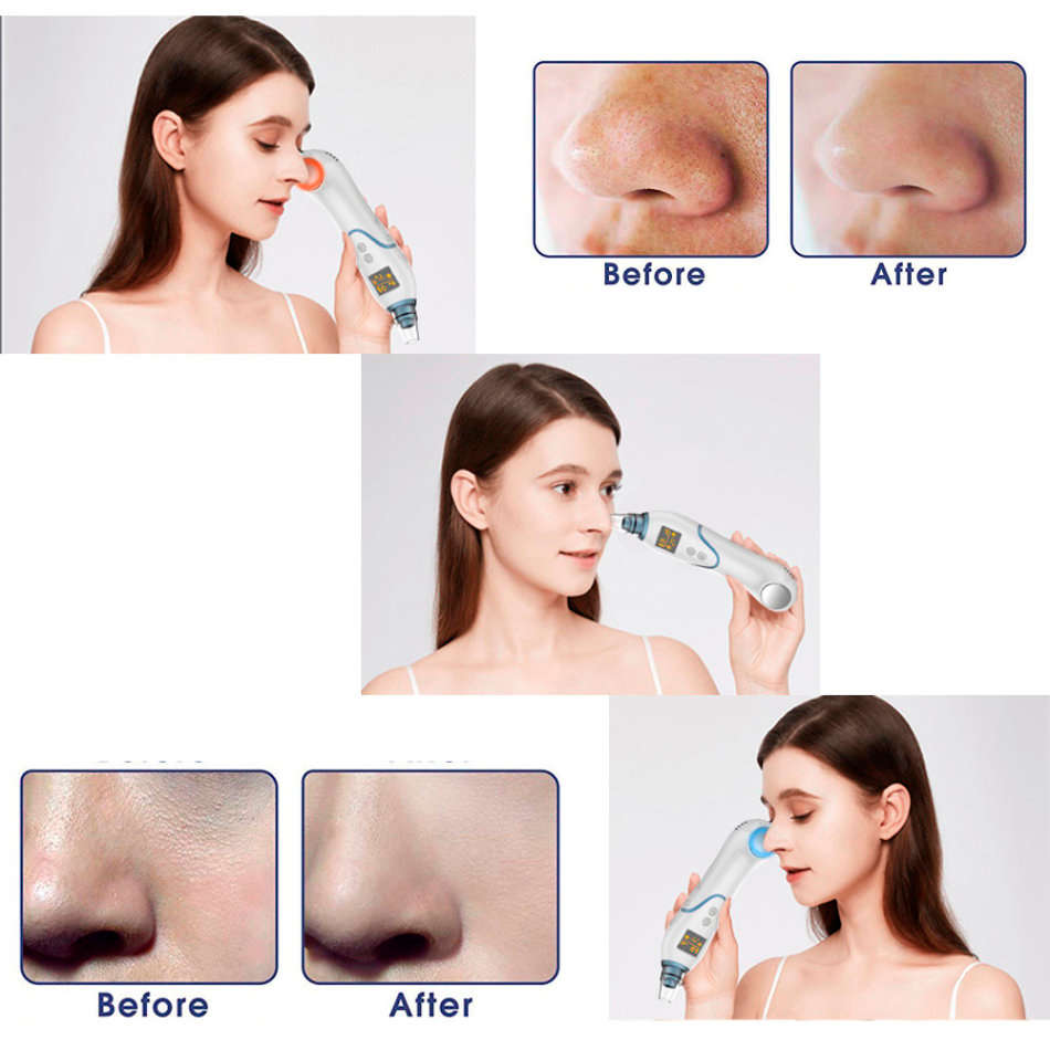 LED Display Blackhead Remover Vacuum Pore Cleaner with Cold Hot Compress Unboxed