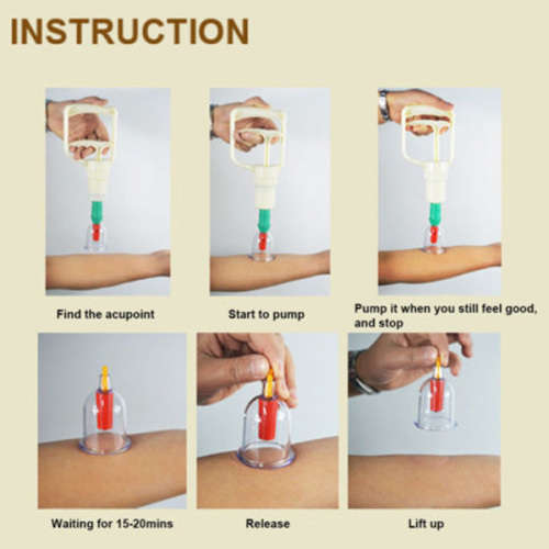 24 Cups Biomagnetic Vacuum Body Cupping Therapy Set Unboxed