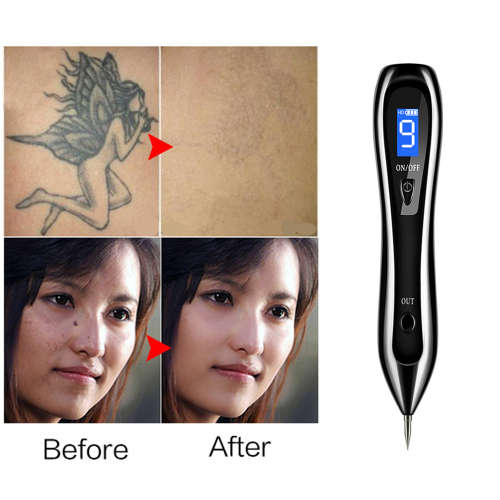 9 level LCD Face Skin Dark Spot Remover Mole Tattoo Laser Pen-Black
