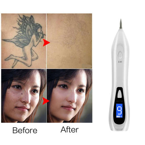 9 level LCD Face Skin Dark Spot Remover Mole Tattoo Laser Pen-White