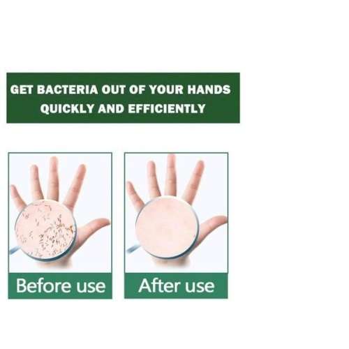 75% Alcohol Disinfection Disposable Hand Sanitizer (DELIVERY DURING LOCK-DOWN)