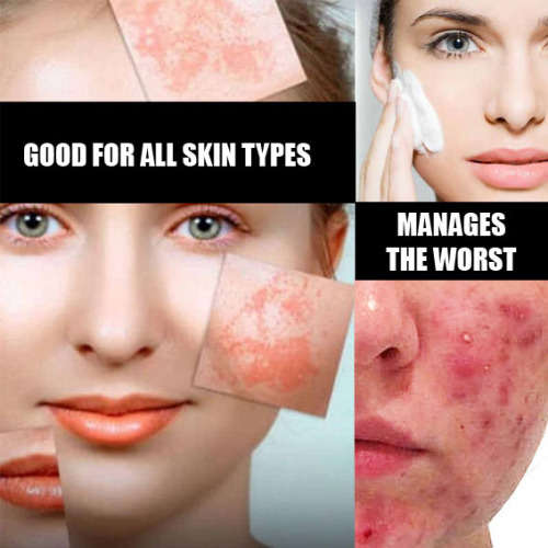 Snail Cream - The Anti-Aging Agent That Removes Wrinkles And Repairs Skin