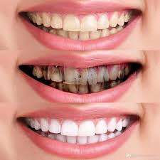 Restore Your Smile With A Detoxing Charcoal Whitening Toothpaste