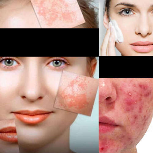 Snail Cream - The Anti-Aging Agent That Removes Wrinkles And Repairs Skin