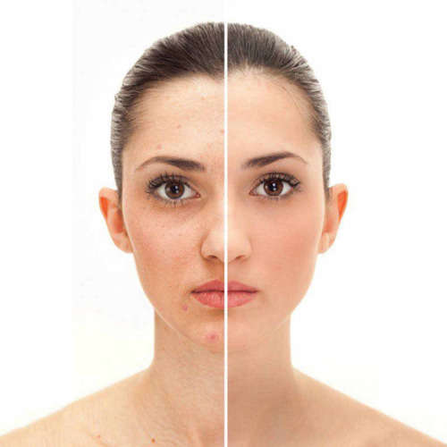 Snail Cream - The Anti-Aging Agent That Removes Wrinkles And Repairs Skin