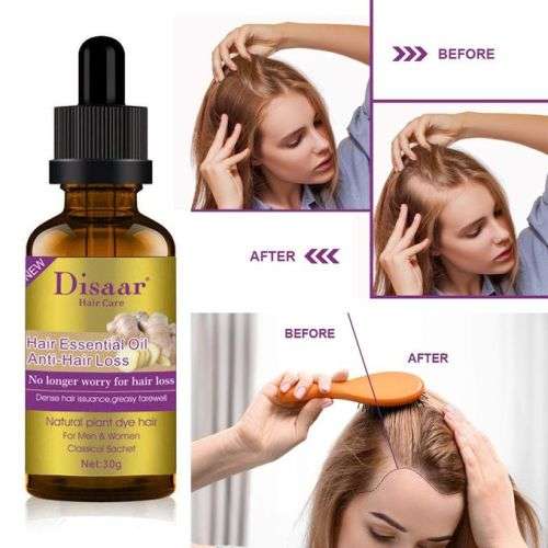 Disaar Ginger Hair Essential Oil - Anti Hair Loss Oil 40g