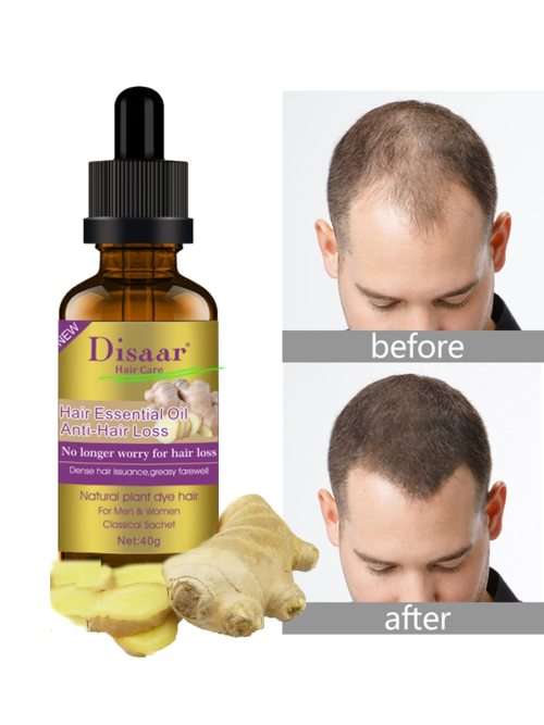 Disaar Ginger Hair Essential Oil - Anti Hair Loss Oil 40g