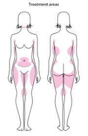 Lipo Lab Fat Dissolving Injections: The Original LipoLab- 1x10ml Lipolysis Injection Vial-