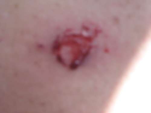 TIPX MEGA PROTECTION PACK