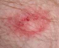 TIPX MEGA PROTECTION PACK