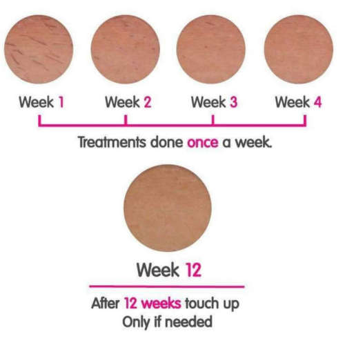 Permanent IPL Epilator Hair Removal Device