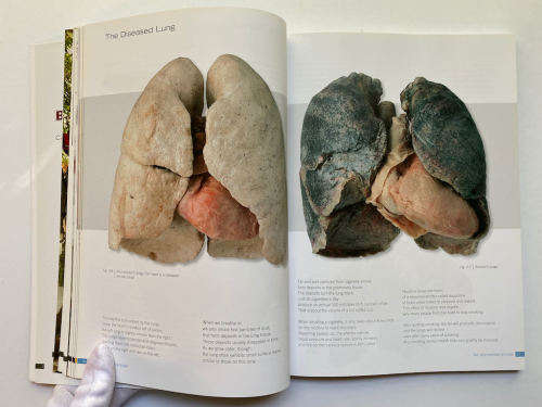 Body Worlds: The Original Exhibition of Real Human Bodies by Gunther von Hagen`s