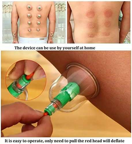 12PCS Chinese Vacuum Cupping Kit Pull Out a Vacuum Apparatus Therapy Set