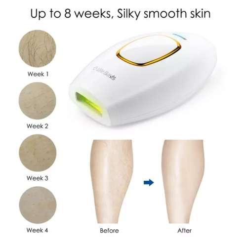 IPL Laser Hair removal Handset