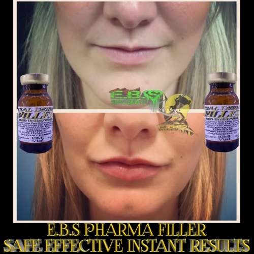 Facial FillerEbs Pharma Sa Facial Filler100 Unit Syringe