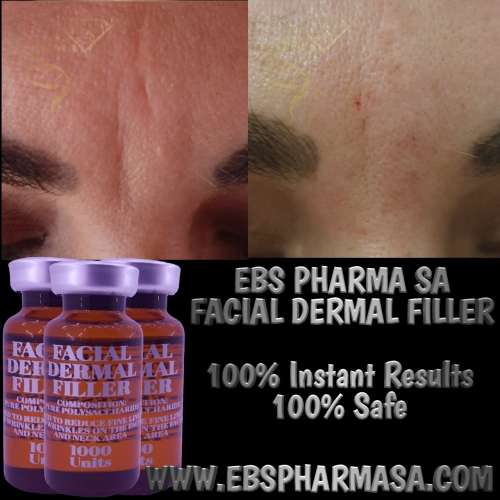 Facial FillerEbs Pharma Sa Facial Filler100 Unit Syringe