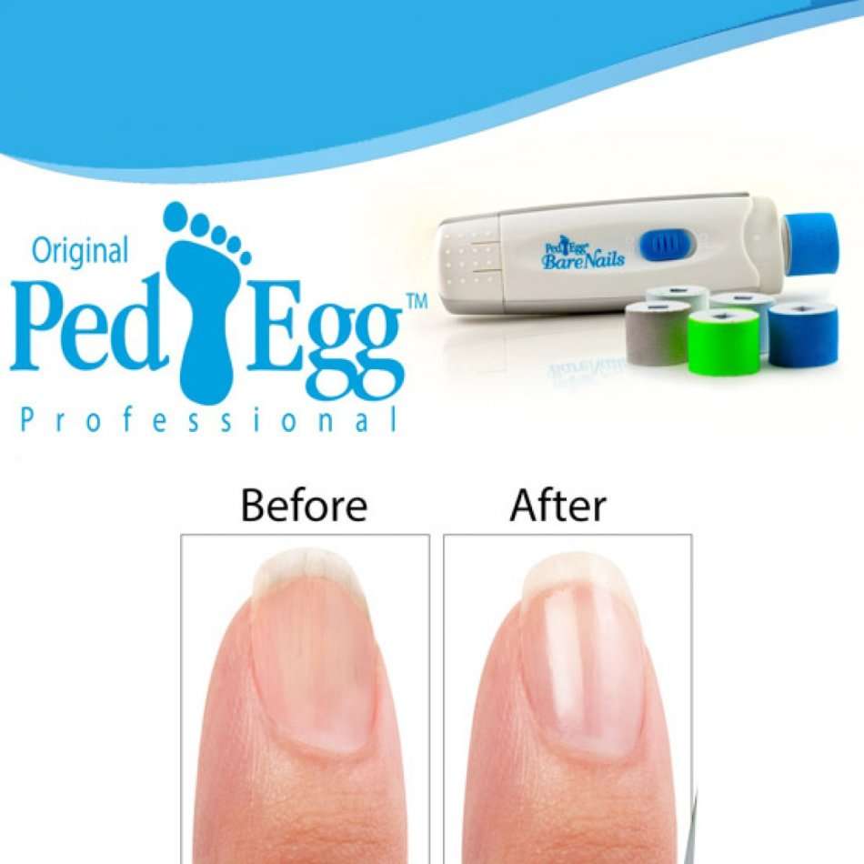 PedEgg Bare Nails Electronic Nail Care System - Buff & Shine Nails
