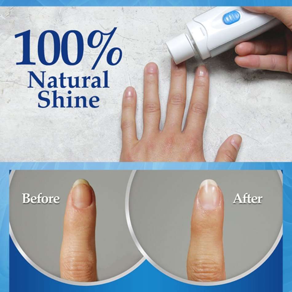 PedEgg Bare Nails Electronic Nail Care System - Buff & Shine Nails