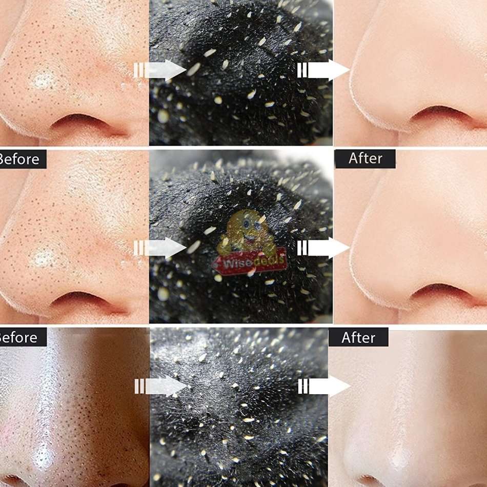 Electric Vacuum Blackhead Remover, Lift skin Elasticity and Make the Skin Tighten, More Radiant