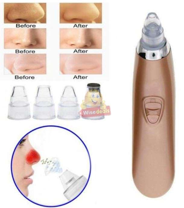 Electric Vacuum Blackhead Remover, Lift skin Elasticity and Make the Skin Tighten, More Radiant
