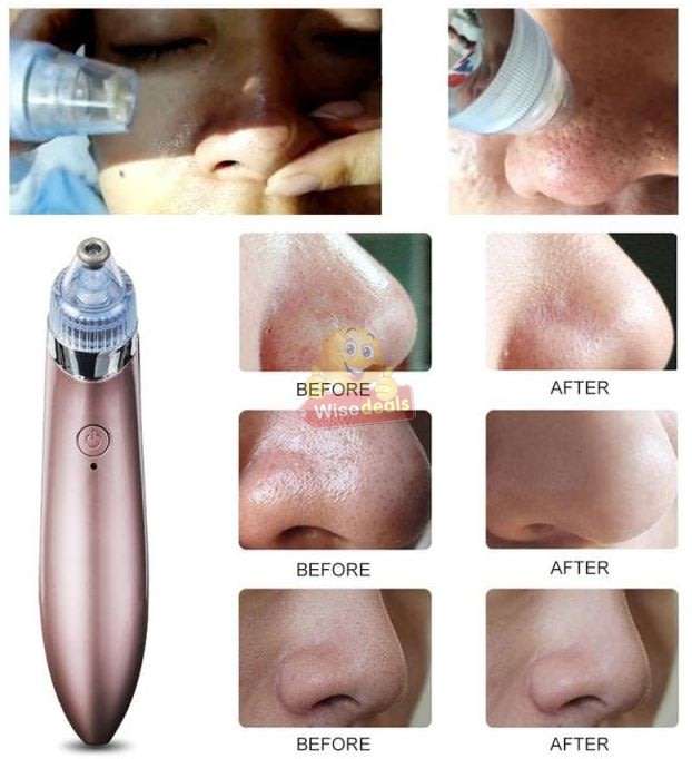 Electric Vacuum Blackhead Remover, Lift skin Elasticity and Make the Skin Tighten, More Radiant
