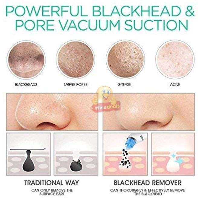 Electric Vacuum Blackhead Remover, Lift skin Elasticity and Make the Skin Tighten, More Radiant