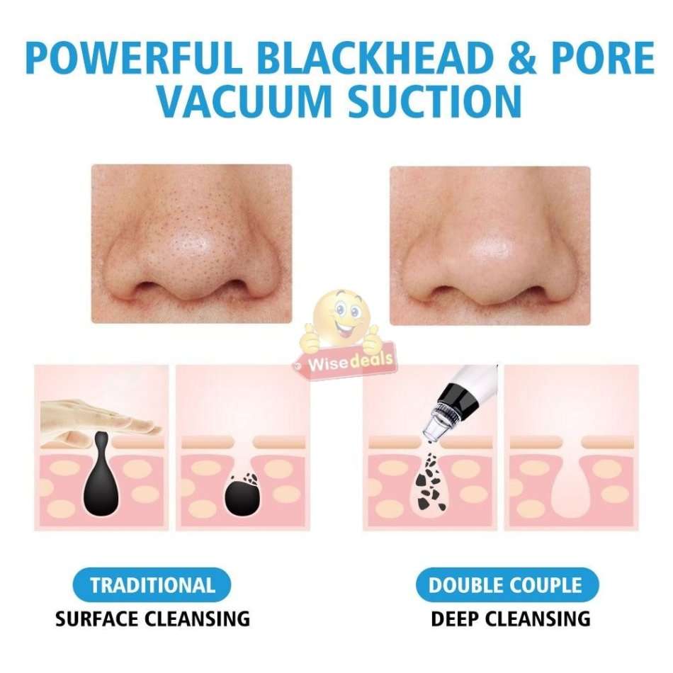 Electric Vacuum Blackhead Remover, Lift skin Elasticity and Make the Skin Tighten, More Radiant