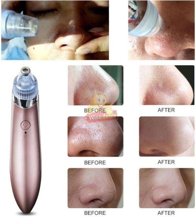 Electric Vacuum Blackhead Remover, Lift skin Elasticity and Make the Skin Tighten, More Radiant