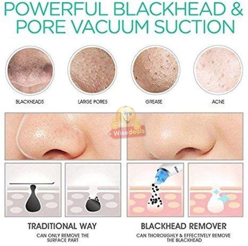 Electric Vacuum Blackhead Remover, Lift skin Elasticity and Make the Skin Tighten, More Radiant