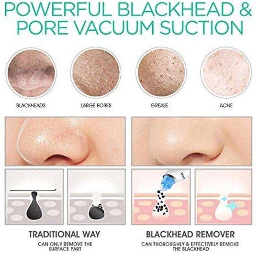 Electric Vacuum Blackhead Remover
