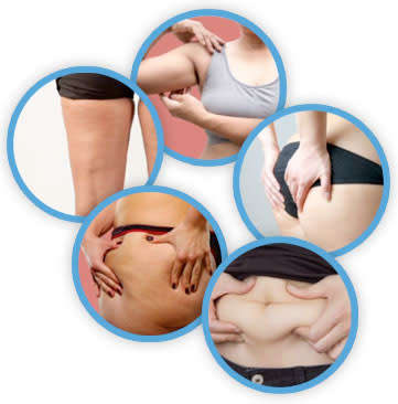 Special.Buy 1 get 1 free. Garcinia 95% HCA.60 caps.Safe reliable slimming works for centuries