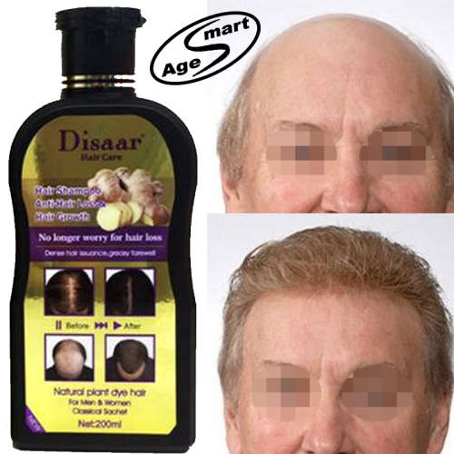 #1 Ginger Strong hair regrow shampoo  DHT hormone blocker.Gray hair natural reversal.200ml
