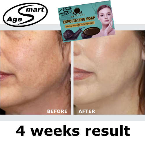 #1 Cosmetic skin whitening soap 100g.Anti-aging,whitening,exfoliating.Snail and Argan oil.Anti spot