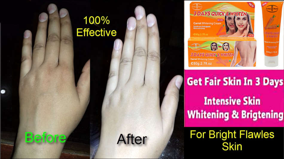 3 days quick whitening carrot whitening face and body cream. 80g , Scars/Marks, Age Spots/Freckles