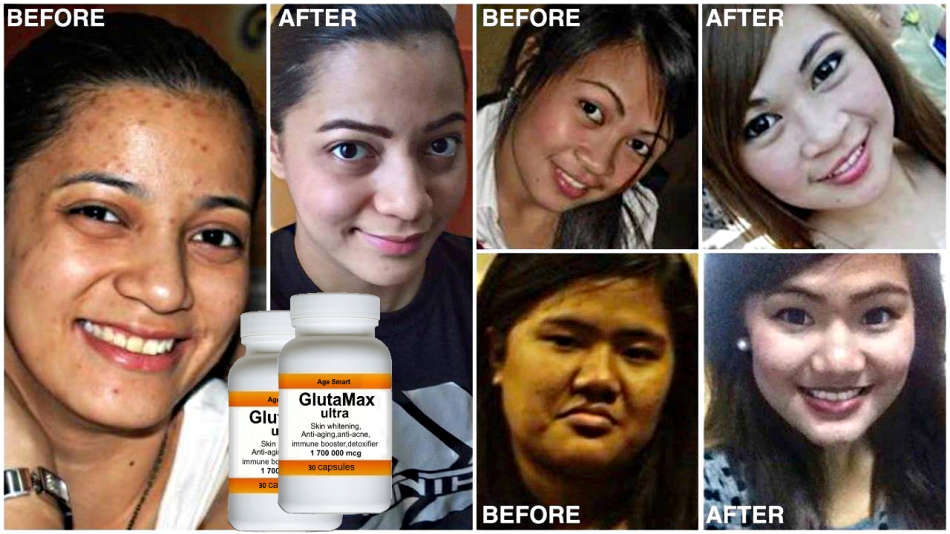 # 3+1 Christmas special.1700000mcg GlutaMax 30 caps.Skin whitening, anti-aging,detox,slimming acne