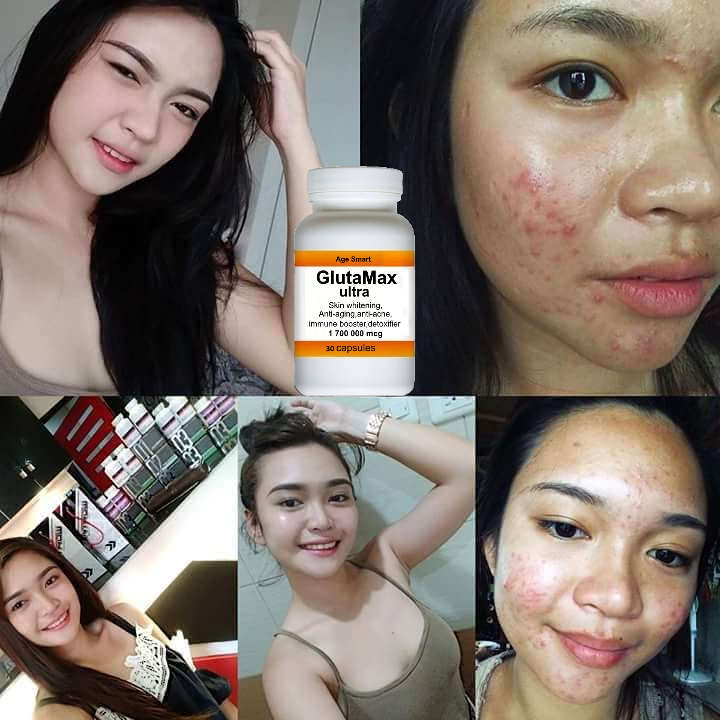 # Christmas special.1700000mcg GlutaMax 30 caps.Skin whitening, anti-aging,detox,slimming acne