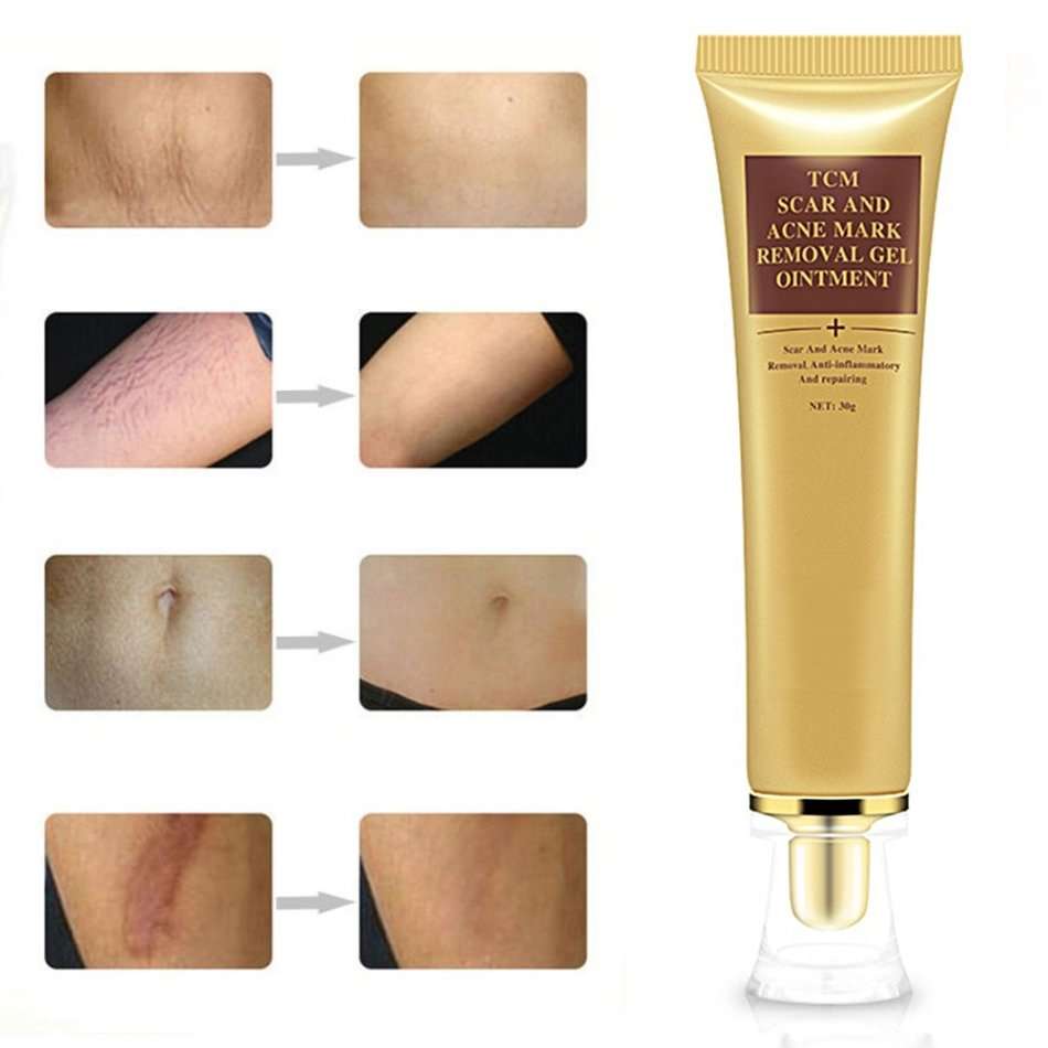 TCM skin scar & acne marks removal gel oitment.30g. anti-inflamatory repair .